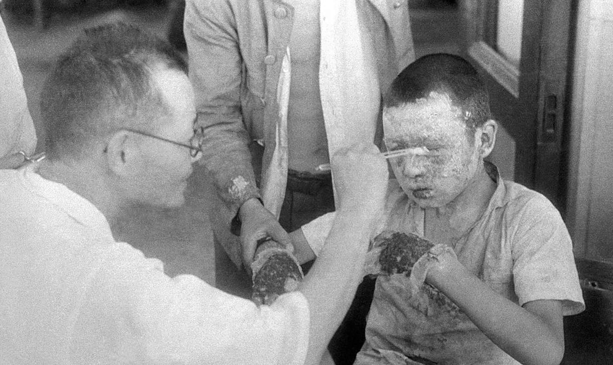 Médico limpa os ferimentos de uma criança afetada pela bomba nuclear